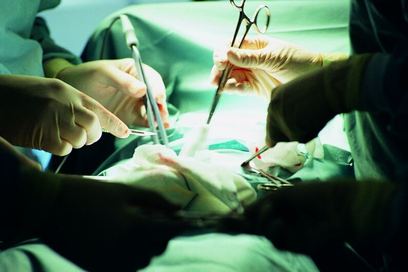 zakilaren lodieraren gehikuntza kirurgikoa