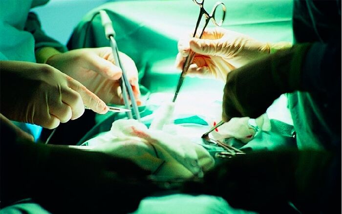 Gihar transplantea mikrokirurgikoa